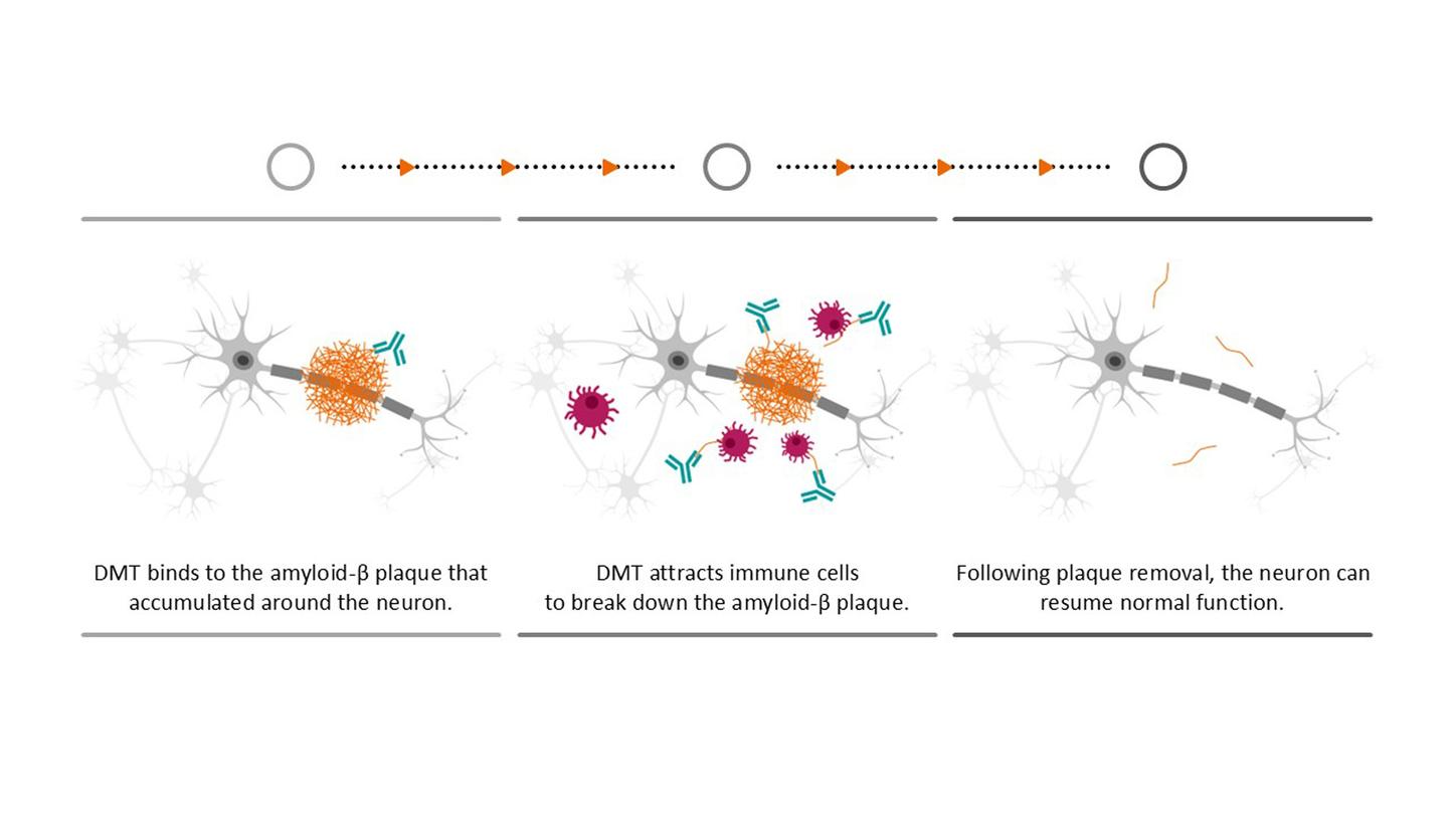 Siemens Healthineers Alzheimer disease modifying therapies